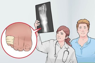 How to Tape a Broken Pinky Toe