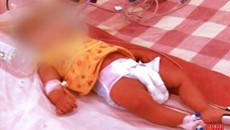 Baby Afreen case: Custody of father extended