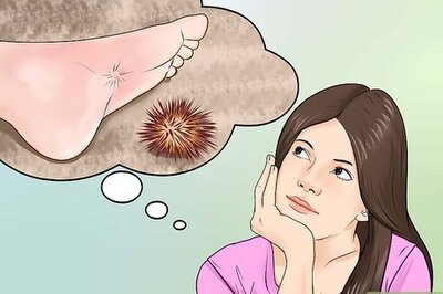 How to Treat Sea Urchin Stings