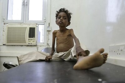 Cholera Outbreak in Yemen Kills 115, Leaves 8500 ill
