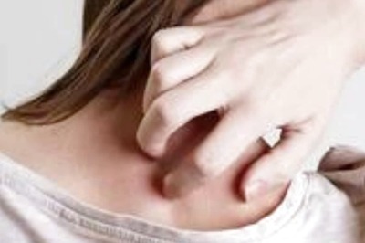 10 Diabetic Skin Conditions And Their Symptom That You Need To Know