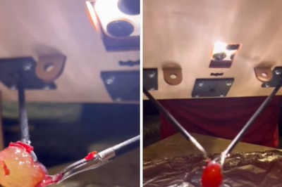 Surgeon-In-Training Uses His Skills To Peel A Grape For Girlfriend, Internet Calls Him 'Dr Strange'