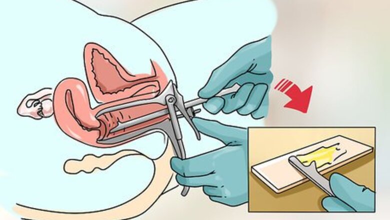 How to Treat Vaginitis