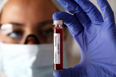 Four Mumbai Resident Doctors Suspected To Be 'Reinfected' By Coronavirus