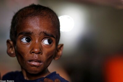 NHRC Notice to MP Govt Over Death of 116 Children