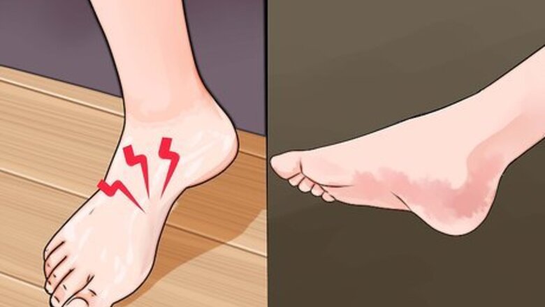How to Avoid Fallen Arches