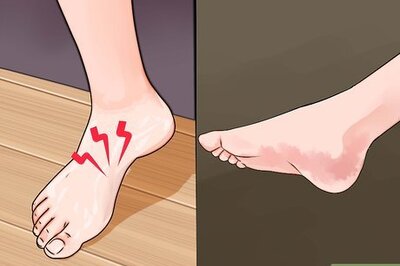 How to Avoid Fallen Arches