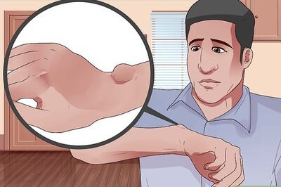 How to Cope With Having a Ganglion