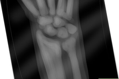 How to Prevent Thyroid Cancer