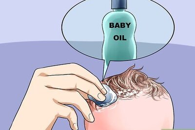 How to Easily Clean Baby's Cradle Cap Dandruff Without Hurting the Baby