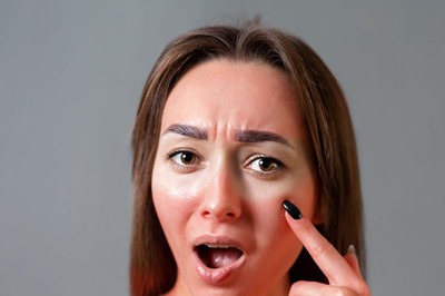 Know the Cause and Treatment of Heat Strokes