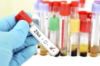 This New Canadian Technology Can Successfully Check Zika Virus