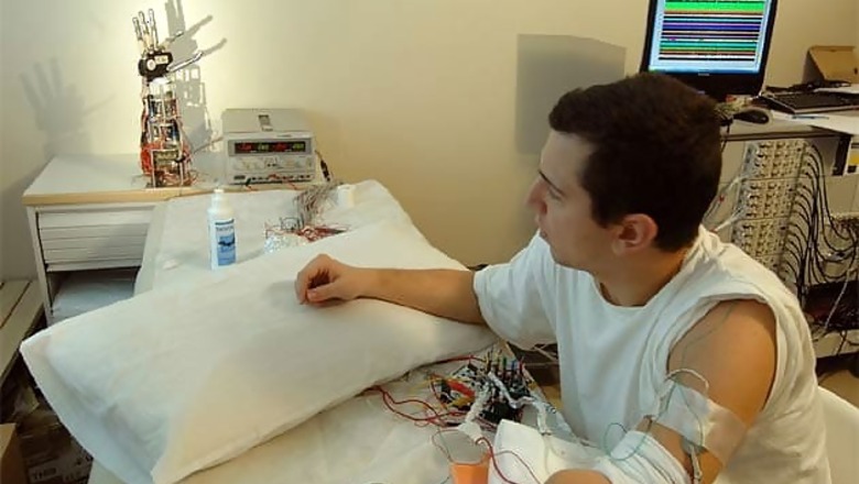 World's first artificial hand allows patients to feel touch