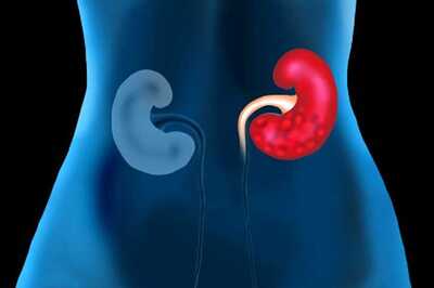 World Kidney Day: A Complete Guide to Keep Your Kidneys Healthy