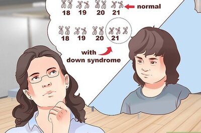 How to Help a Child with Down Syndrome