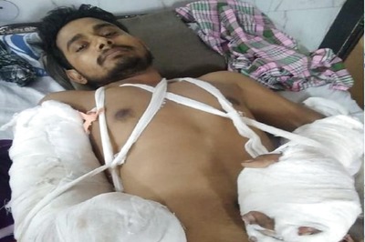 Muslim Riots Victim Says He Lost His Arm in a Blast, Delhi Police File 'Accident' FIR