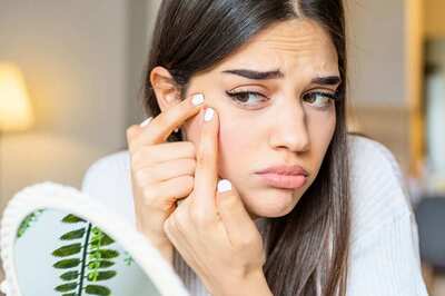 Do You Have Acne-Prone Skin? Follow These Key Makeup Tips for Better Results