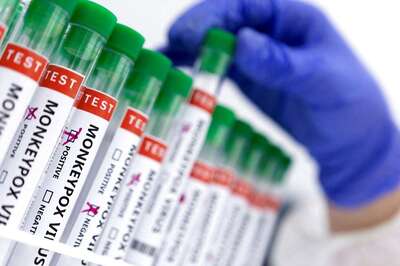 Monkeypox Unlike Coronavirus, Won’t Spread Like Wildfire: ICMR's Top Virologist to News18