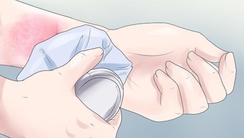How to Stop a Rash from Itching