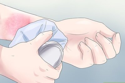 How to Stop a Rash from Itching