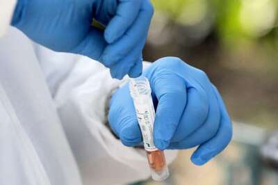 AMU Biochemistry Alumnus Develops Affordable Covid-19 Rapid Testing Kits