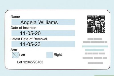 How to Remove Nexplanon