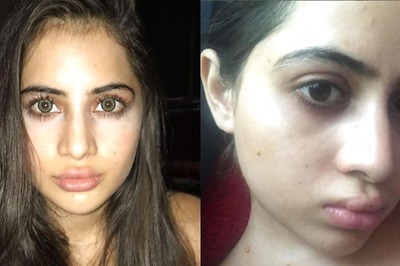 Urfi Javed Defends Fillers, Plastic Surgery, Says ‘Do It Instead of Hating Yourself’; Fans React