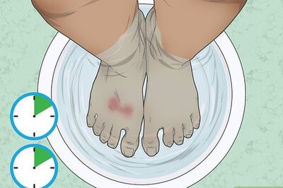 How to Treat Wax Burns