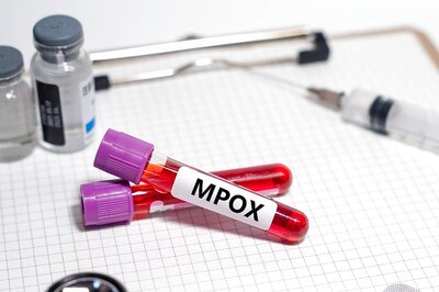 Debunking Common Myths About Mpox: What You Need to Know