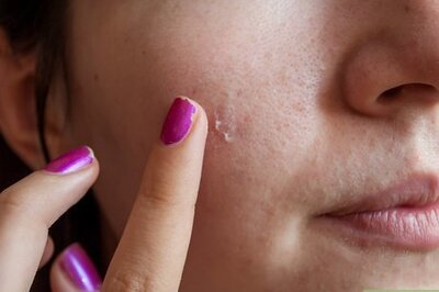 How to Use Green Eyeshadow to Cover a Red Pimple