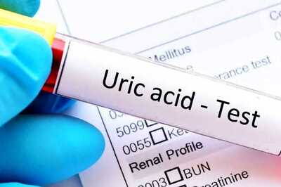 Lemon Water To Turmeric Milk, 5 Easy-to-make Drinks To Control Uric Acid Levels