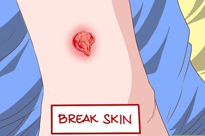 How to Identify Symptoms of MRSA