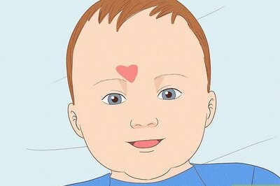 The Spiritual Meaning of Angel Kiss Birthmarks