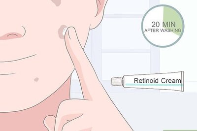 How to Get Rid of Sunspots