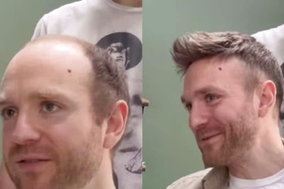 Video Of Bald Man's Incredible Hair Makeover Leaves Internet Amused