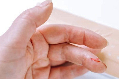 Danish Researcher Explains Why Paper Cuts Hurt So Much