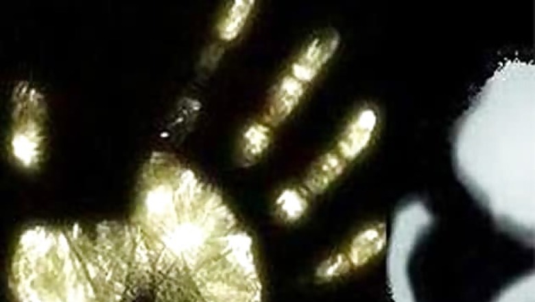 B'lore: 11-yr-old girl set ablaze by 9 persons