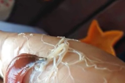 Ribbon Worm's Shocking Ability To Fire Tree-Like Web Is The Stuff Of Nightmares