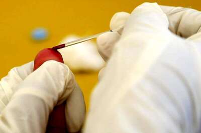 World's First Blood Test to Detect Melanoma Early Developed'