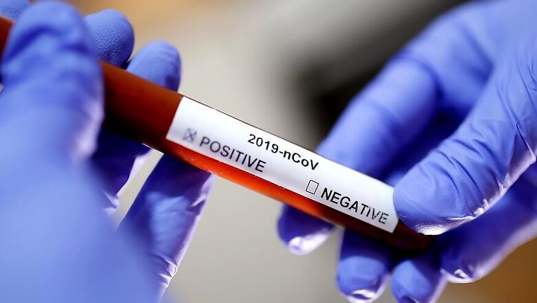 Despite Sporadic Cases, No Evidence Yet of Community Transmission of Coronavirus in India: ICMR