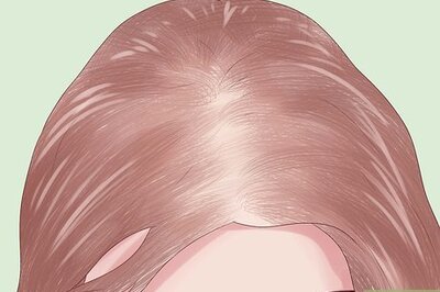 How to Prevent Hair Loss Due to Stress