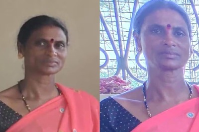 In Karnataka’s Shivamogga, Woman Dies After Being Bitten By A Pet Cat