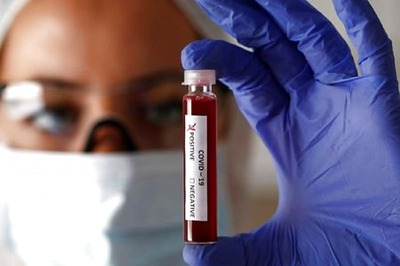 Delhi Assembly Session: 3 AAP MLAs, a Journalist Test Covid-19 Positive