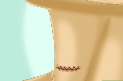 How to Take Care of an Incision After Thyroid Surgery