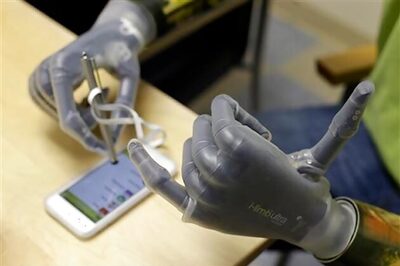 i-limb app lets amputees program their own bionic hands
