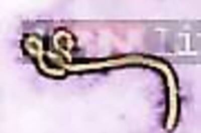 Canada will send experimental Ebola vaccine to WHO