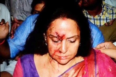 BJP MP Hema Malini discharged from hospital post-surgery, leaves for Mumbai