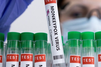 News18 Afternoon Digest: Centre Forms Task Force to Closely Monitor Monkeypox Virus Situation in Country & Other Stories