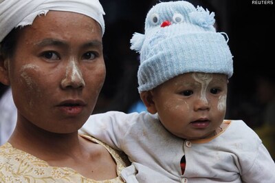 Parasites may protect against allergies