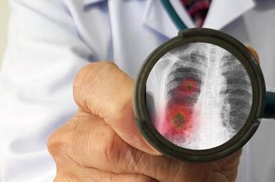 All You Need to Know About COVID Pneumonia and How is it Different From Regular Ones?